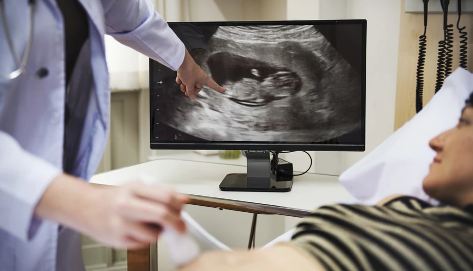 NT (Nuchal Translucency) scan during early pregnancy ultrasound