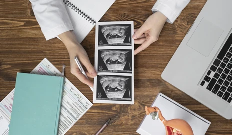 CVS test in pregnancy collecting placental tissue sample for genetic testing