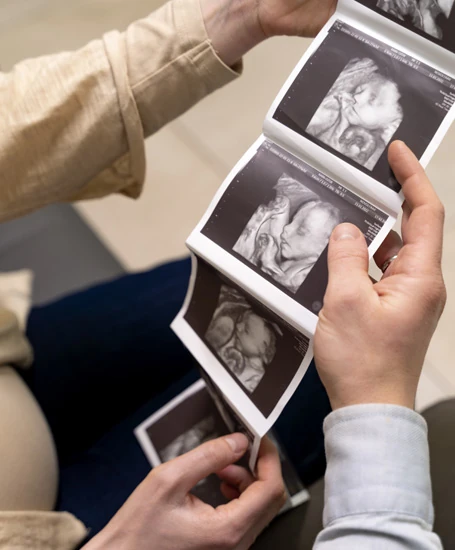 Advanced 3D pregnancy scan used to visualize baby’s features and growth