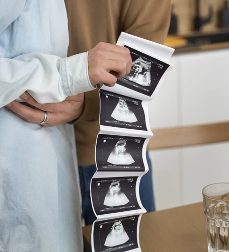 Fetal anomaly scan imaging